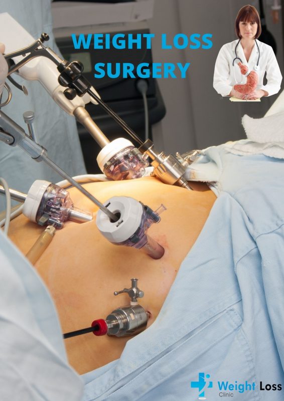 Weight Loss Surgery